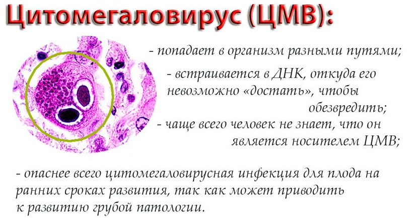 цитомегаловирус лечение